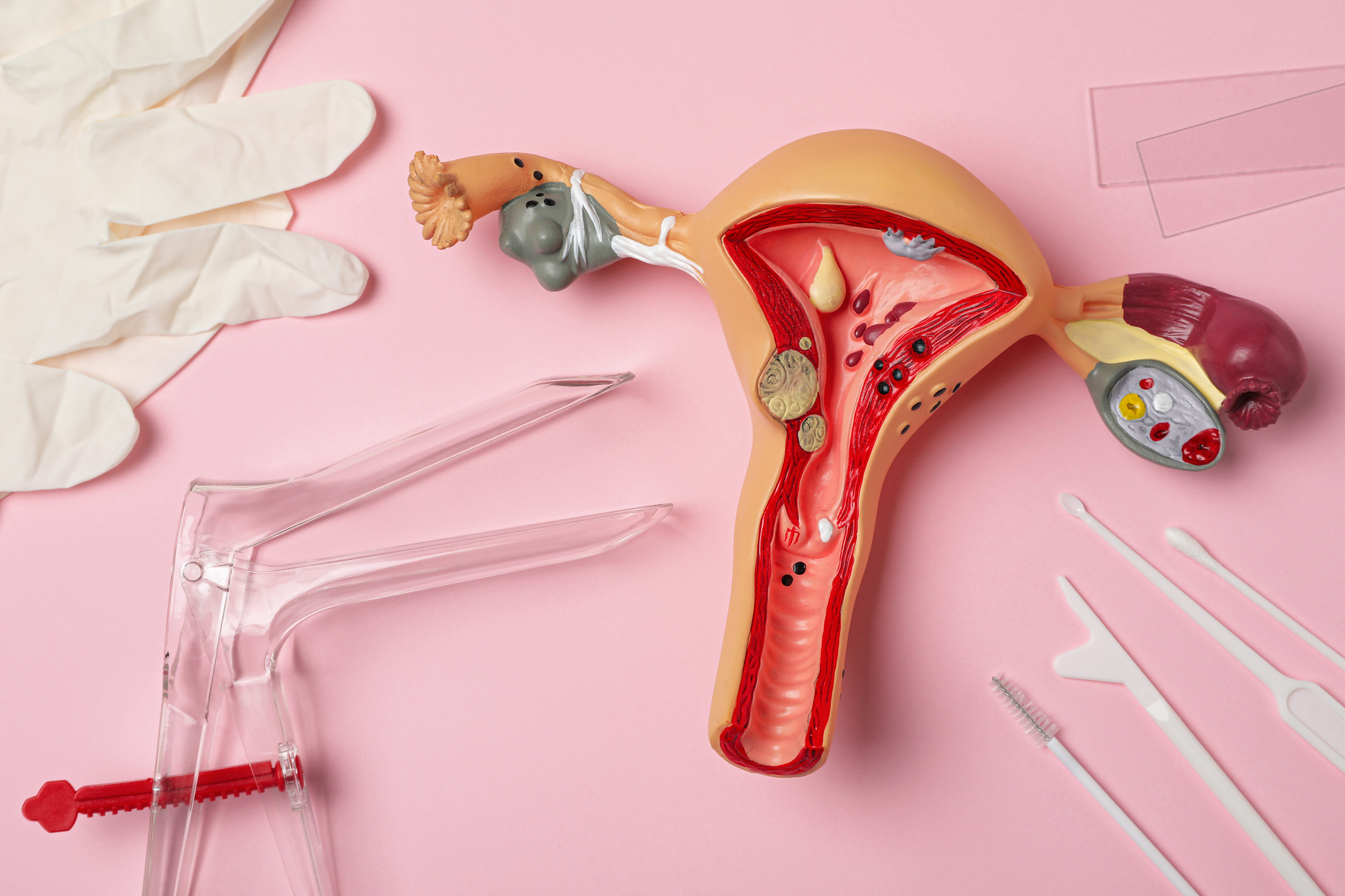 Pap Smear