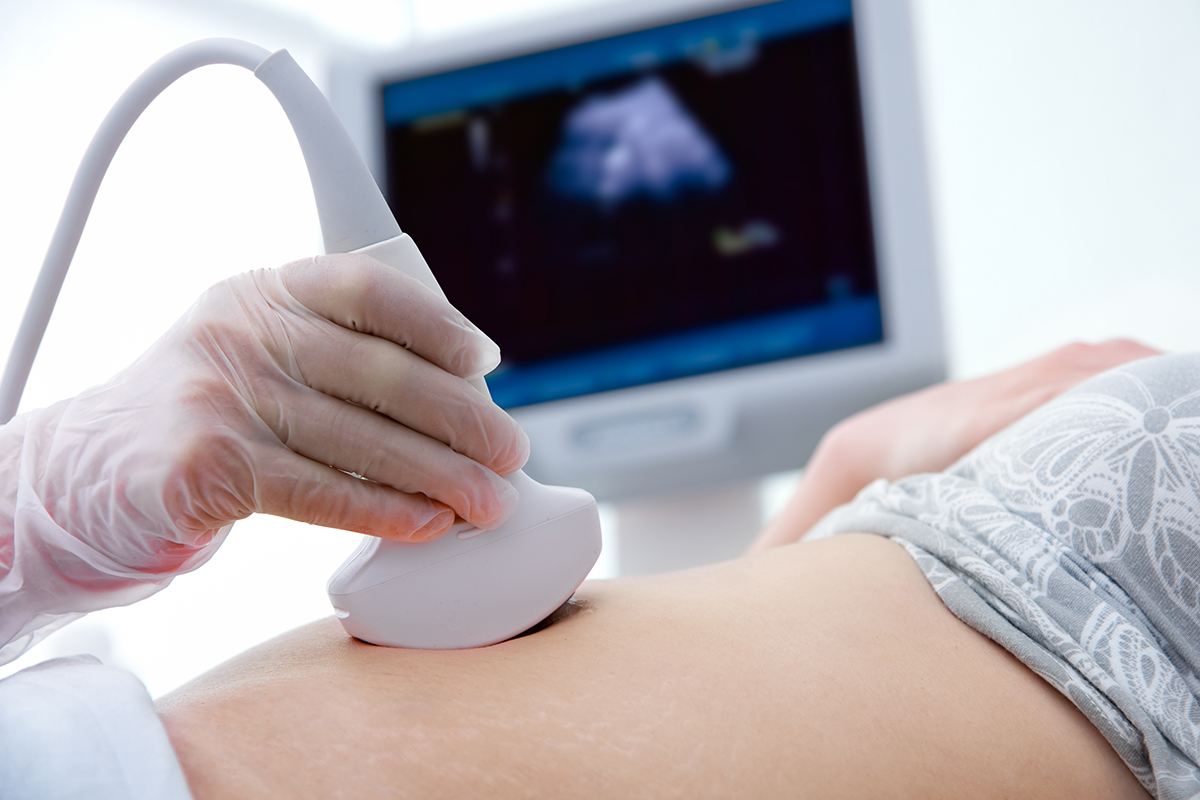 General Ultrasound